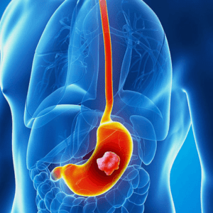 Energetic Stomach Cleanse